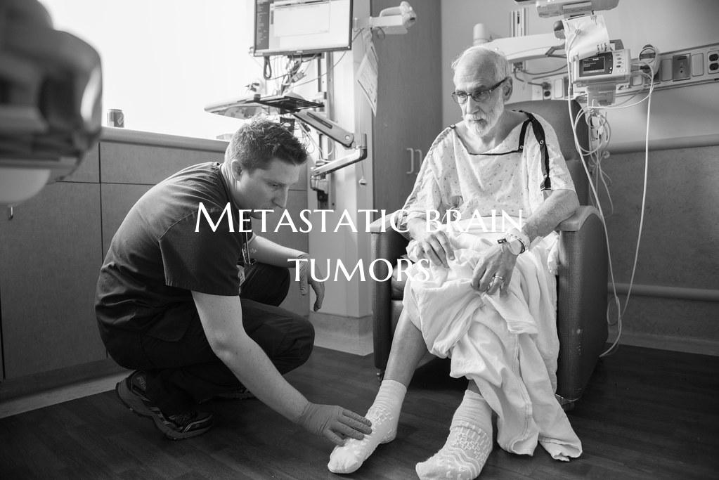 Metastatic brain tumors